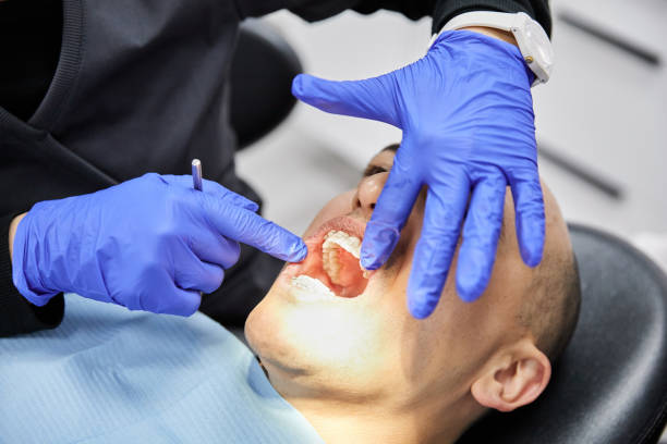 Best Emergency Wisdom Teeth Removal in Hayneville, AL